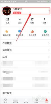 头条怎么设置保存图片